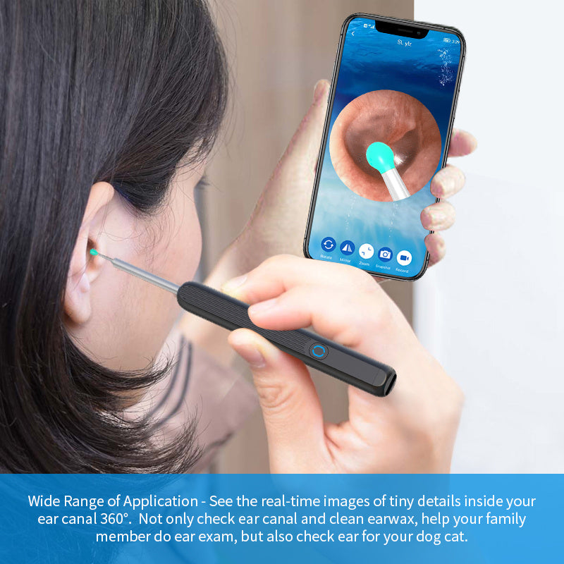 NE3 Ear Cleaner Otoscope Ear - Premium 0 from chiquetrends.com - Just $15! Shop now at chiquetrends.com