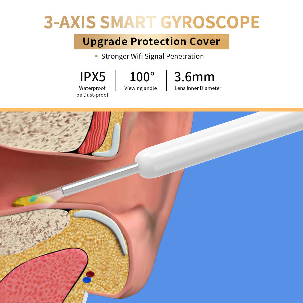 NE3 Ear Cleaner Otoscope Ear - Premium 0 from chiquetrends.com - Just $15! Shop now at chiquetrends.com