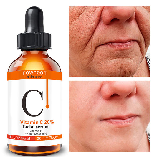 Vitamin C Facial Serum 30ml - Premium 0 from chiquetrends.com - Just $9! Shop now at chiquetrends.com